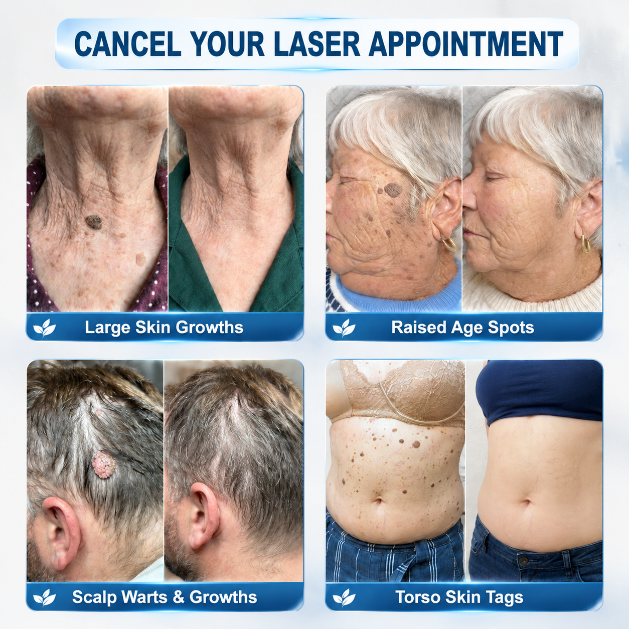 𝐏𝐡𝐚𝐫𝐦𝐚𝐜𝐢𝐬𝐭 𝐑𝐞𝐜𝐨𝐦𝐦𝐞𝐧𝐝𝐞𝐝 ✏️✅ 𝐇𝐞𝐚𝒍𝒓𝒊𝒛𝗲® 𝟳-𝗗𝐚𝐲 𝐓𝐚𝐠 & 𝐒𝒑𝒐𝒕 𝑬𝒓𝒂𝒔𝒆𝒓 🪄 (𝒁𝒆𝒓𝒐𝗣𝗮𝗶𝗻, 𝗭𝗲𝗿𝗼 𝗦𝗰𝗮𝗿𝘀 𝗥𝗼𝗹𝗹𝗲𝗿𝗯𝗮𝗹𝗹) 👩‍⚕️