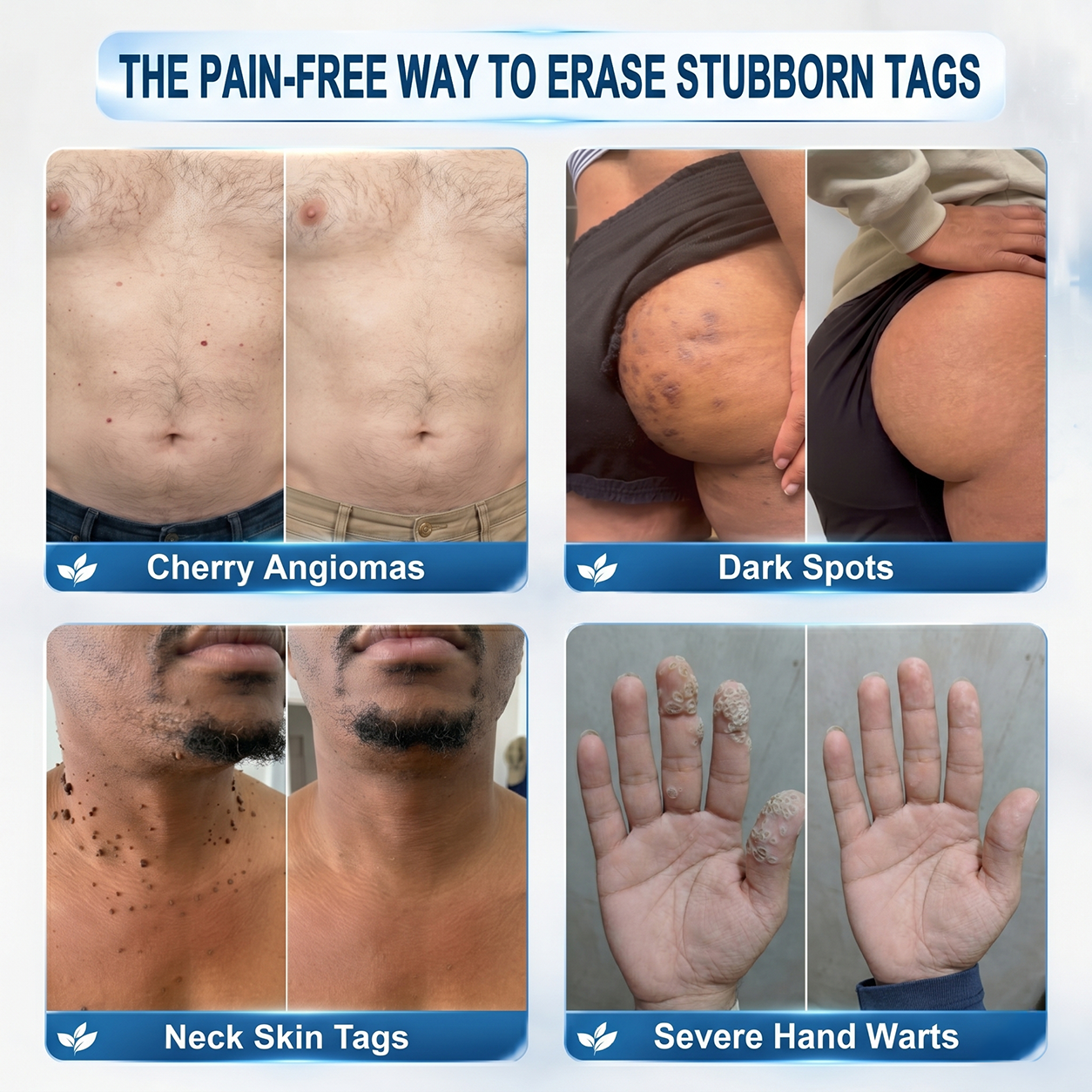 𝐏𝐡𝐚𝐫𝐦𝐚𝐜𝐢𝐬𝐭 𝐑𝐞𝐜𝐨𝐦𝐦𝐞𝐧𝐝𝐞𝐝 ✏️✅ 𝐇𝐞𝐚𝒍𝒓𝒊𝒛𝗲® 𝟳-𝗗𝐚𝐲 𝐓𝐚𝐠 & 𝐒𝒑𝒐𝒕 𝑬𝒓𝒂𝒔𝒆𝒓 🪄 (𝒁𝒆𝒓𝒐𝗣𝗮𝗶𝗻, 𝗭𝗲𝗿𝗼 𝗦𝗰𝗮𝗿𝘀 𝗥𝗼𝗹𝗹𝗲𝗿𝗯𝗮𝗹𝗹) 👩‍⚕️